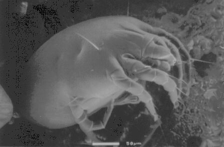Dermatophagoides Pteronyssinus ist eine der am h&auml;ufigsten vorkommenden Hausstaubmilben in Europa (19KB)
