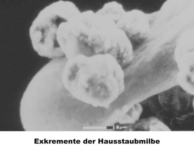Hausstaubmilbenexkremente (20KB)