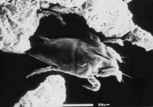 Eine vertrocknete Milbe - wenn sie zerf&auml;llt entstehen Partikel, die ebenfalls Milbenallergene enthalten (9KB)