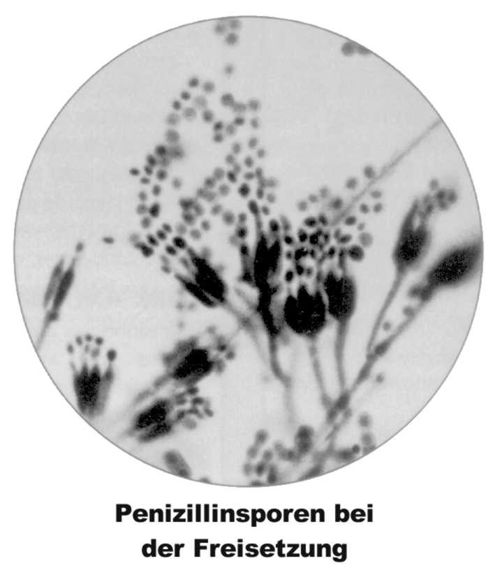 Penizillinsporen (29KB)